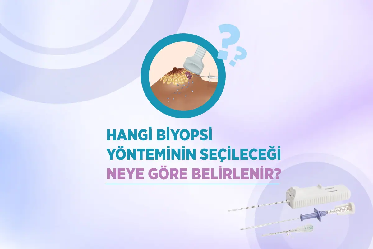 Lenf Nodu Biyopsisi 3 biyopsi yontemi neye gore belirlenir