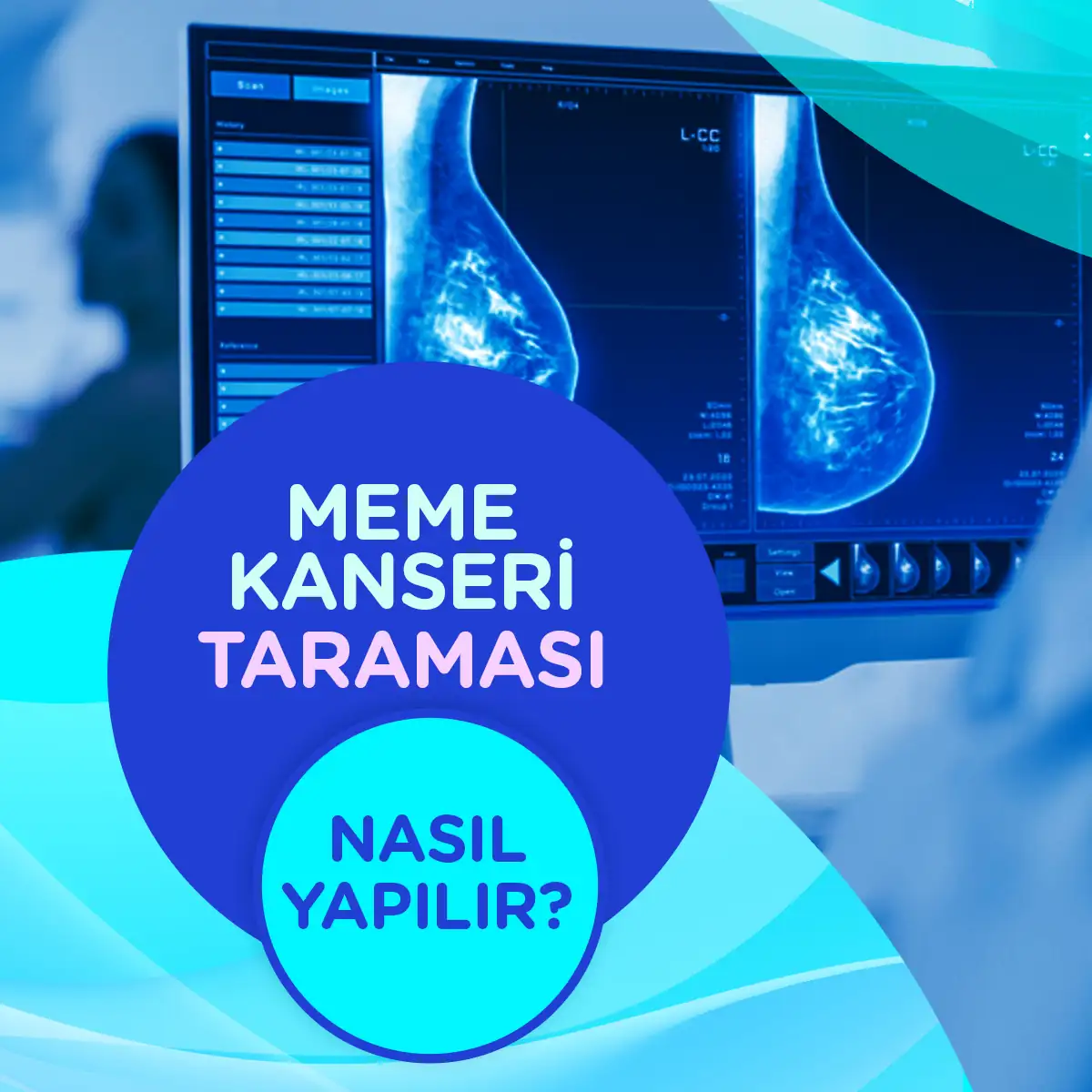 Meme Kanseri Taraması 1 gogus kanseri taramasi nasil yapilir