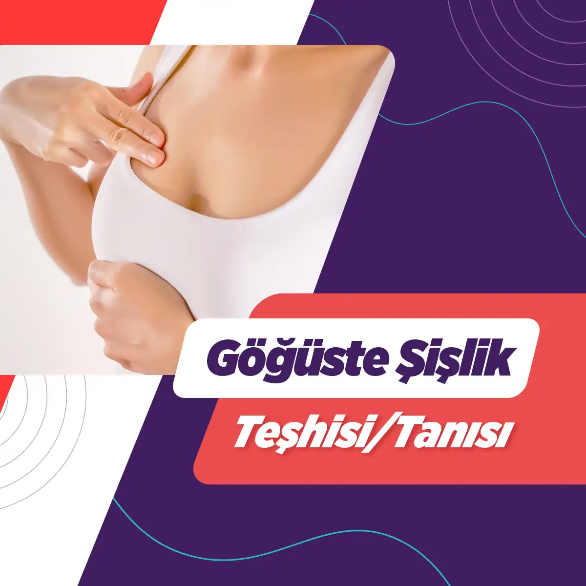 Memede Şişlik 5 goguste sislik teshisi