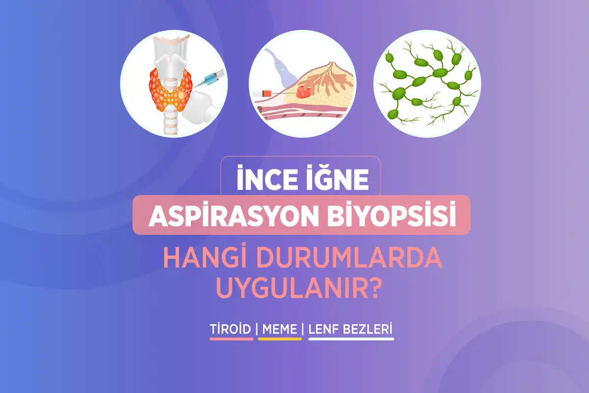 İnce İğne Aspirasyon Biyopsisi 2 ince igne aspirasyon biyopsisi hangi durumlarda uygulanir