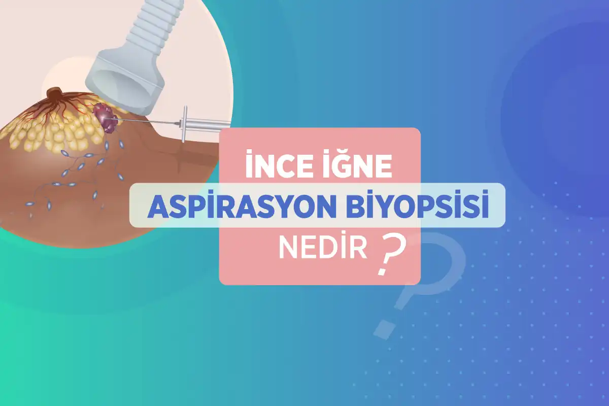 İnce İğne Aspirasyon Biyopsisi 1 ince igne aspirasyon biyopsisi nedir