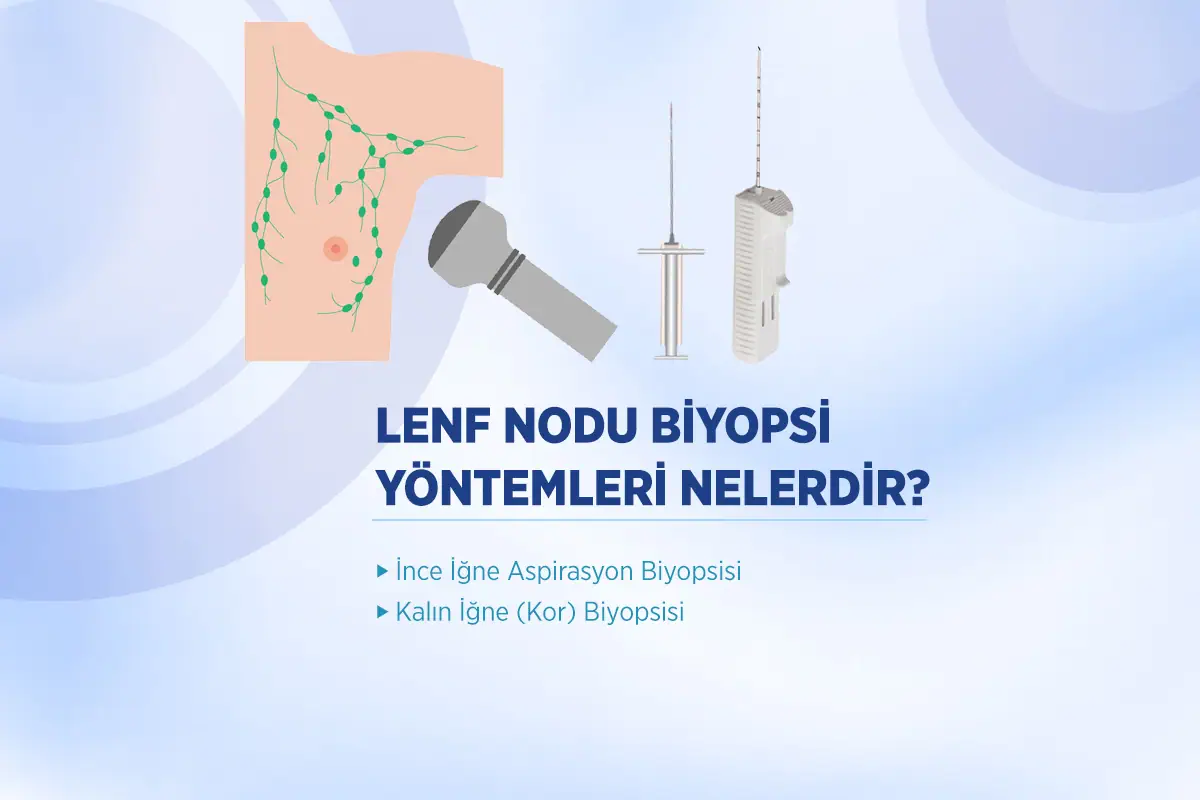 Lenf Nodu Biyopsisi 2 lenf nodu biyopsi yontemleri