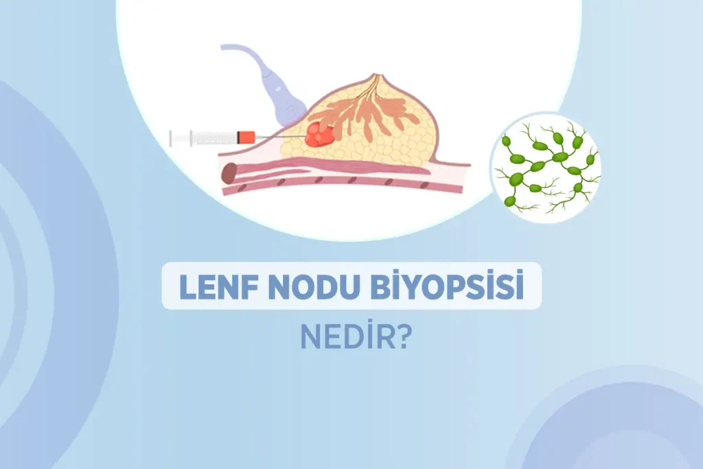 Lenf Nodu Biyopsisi 17 lenf nodu biyopsisi nedir