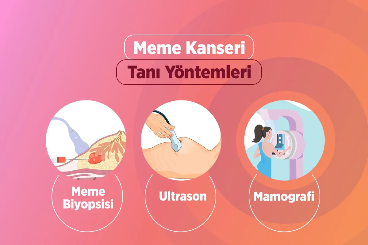 Meme Kanseri 3 meme kanseri tanyontemleri