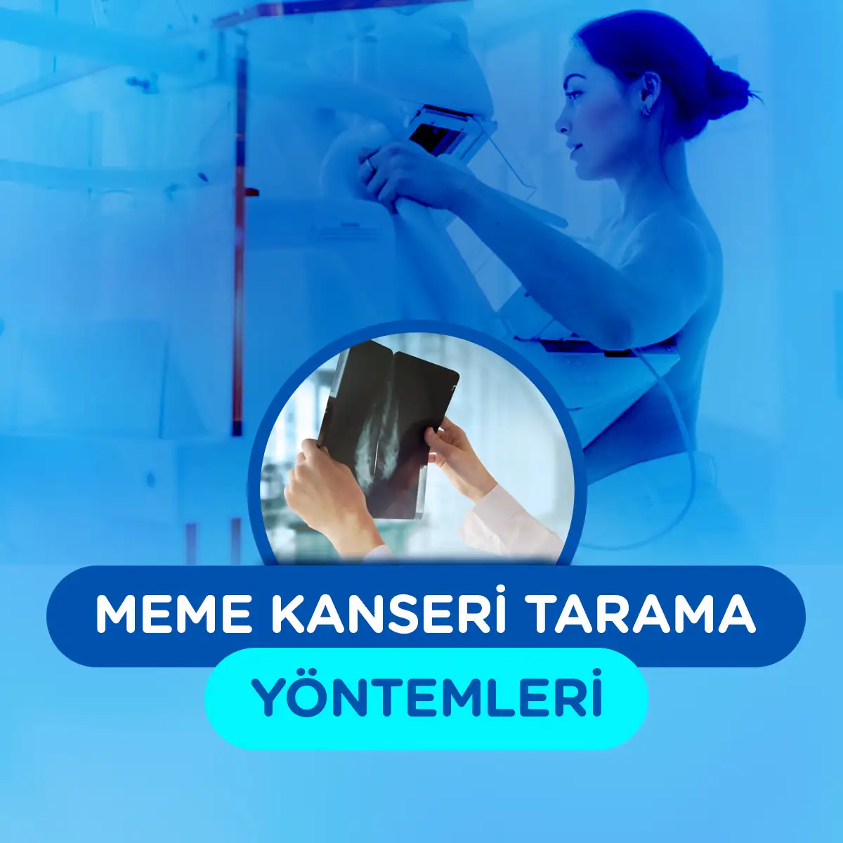 Meme Kanseri Taraması 2 meme kanseri tarama yontemleri
