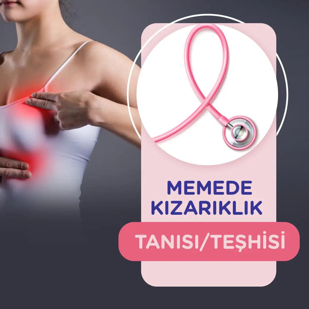 Memede Kızarıklık 2 meme kizariklik teshisi