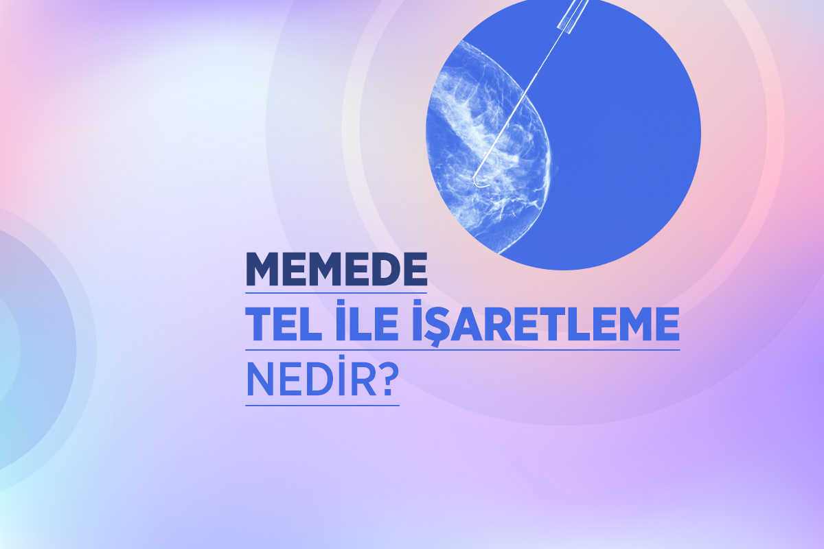 Memede Tel ile İşaretleme 1 memede tel ile isaretleme nedir