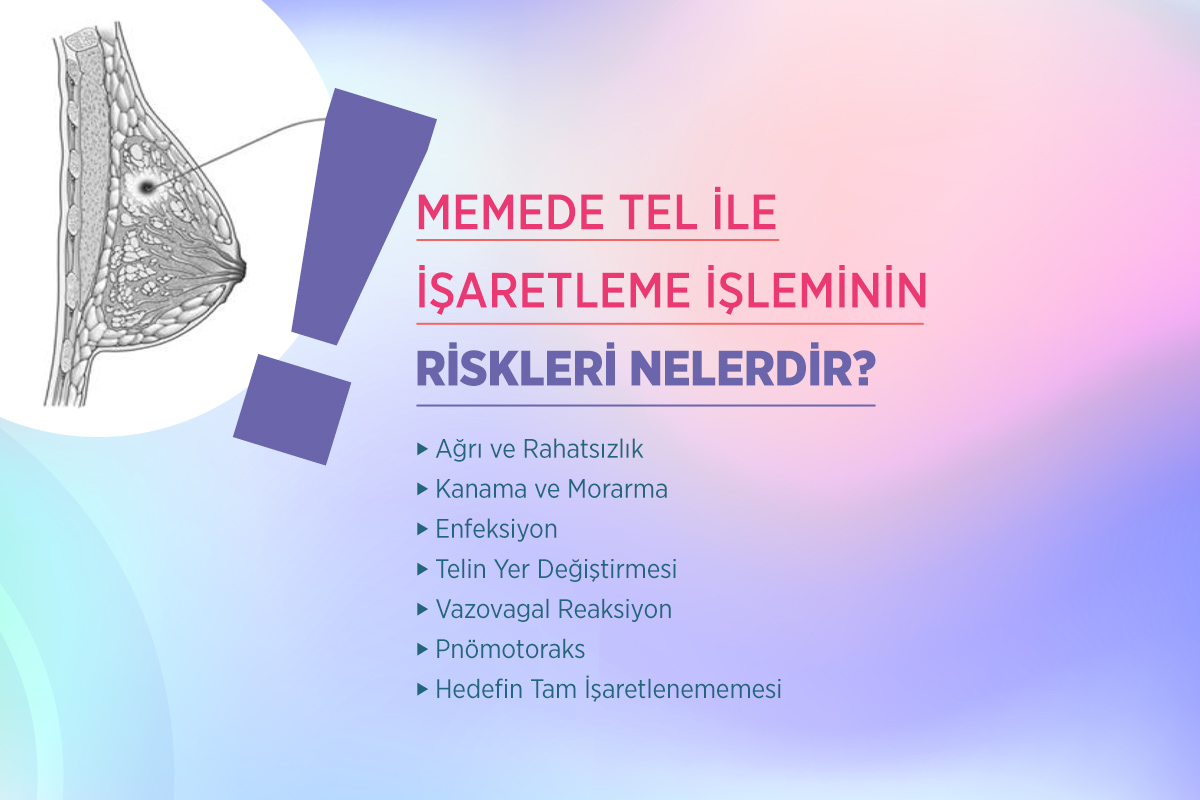 Memede Tel ile İşaretleme 3 memede tel ile isaretlemenin riskleri