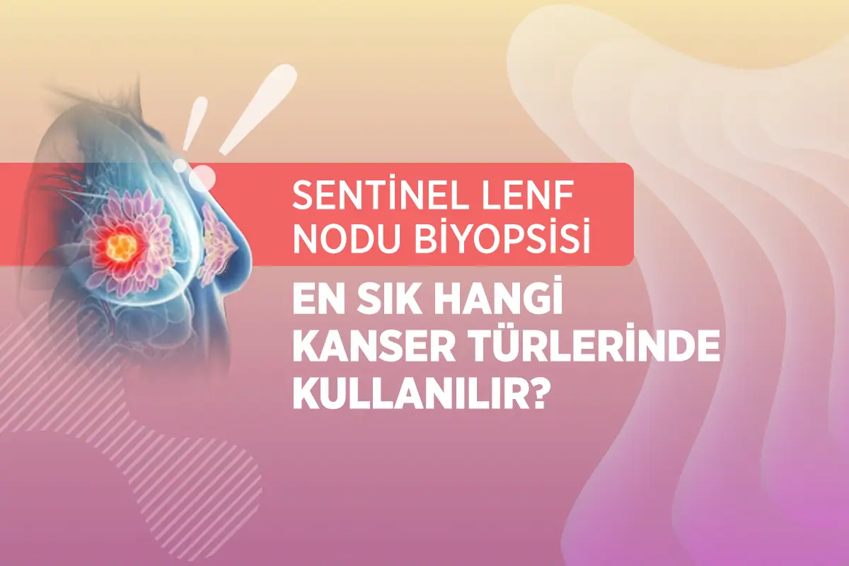Sentinel Lenf Nodu Biyopsisi 2 sentinel lenf nodu biyopsisi hangi kanser turlerinde kullanilir