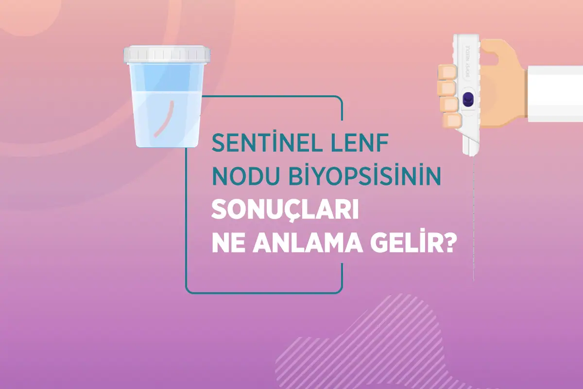 Sentinel Lenf Nodu Biyopsisi 3 sentinel lenf nodu biyopsisi sonuclari