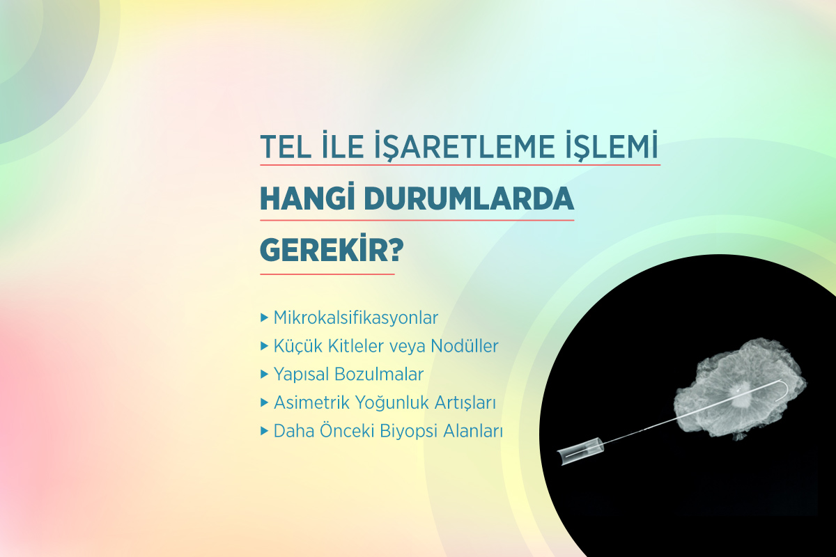 Memede Tel ile İşaretleme 2 tel ile isaretleme islemi hangi durumlarda yapilir